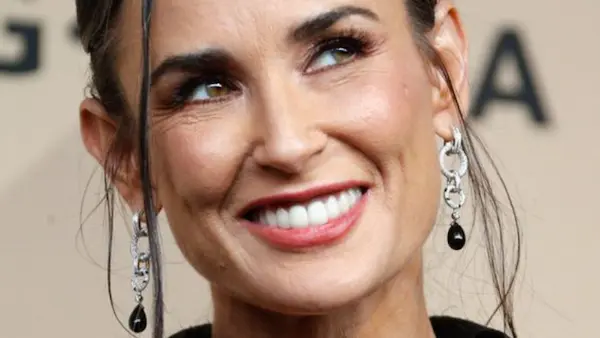 Preguntas frecuentes sobre sonrisas perfectas mujeres